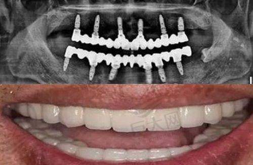 再生牙齿真假情况与当前医学技术的关系
