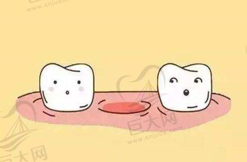 更新后宁波市区口腔医院种植牙收费详情