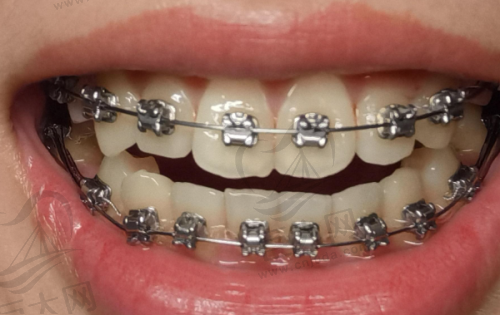 常州北极星口腔收费价格是否合理