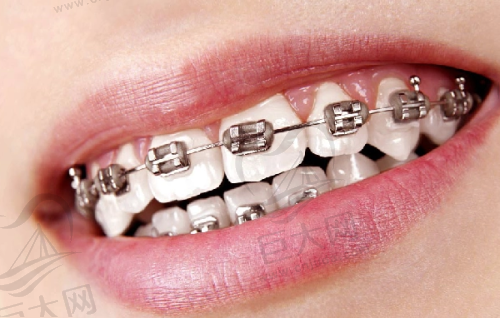 东莞好佰年口腔门诊部收费价格贵不贵