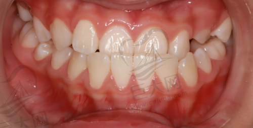 2025年各地区牙齿正畸价格对比