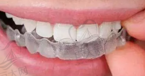 2025年10月30日更新！宁波市区口腔医院补牙、拔牙、矫正等项目收费标准，鄞州区等牙友可参考