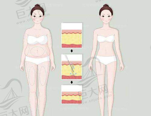 热玛吉项目价格合理