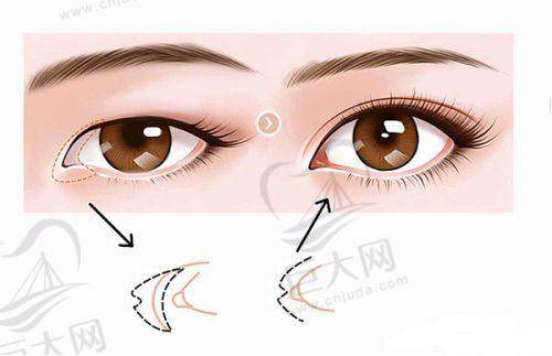 穆宝安/李晓东/张晓健拉皮医生价格表:穆宝安39000元起,李晓东5 - 20万