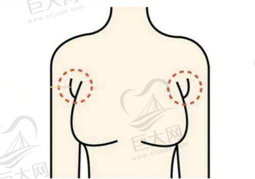 刘志刚院长基础修复类价格