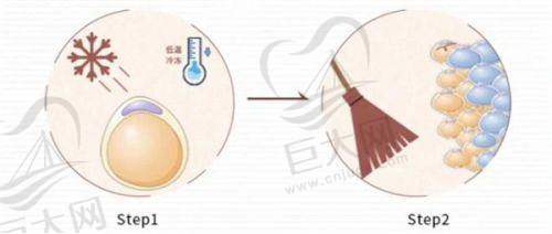 2025北京和广州做微拉美面部提升哪家医院好?优质医院、靠谱医生及价格参考来了!