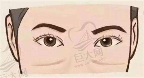 南京医生朱刚强修复鼻子成效