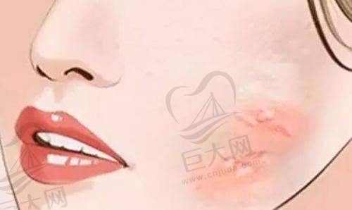 天津时光整形美容门诊部疤痕整形收费价格:疤痕针108元起,剖腹产疤痕179元/平方厘米