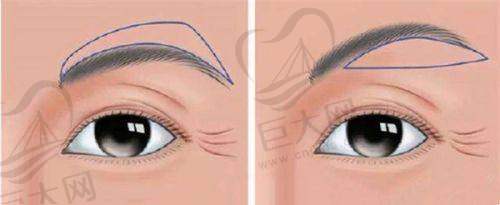 上海九院整形科2025年更新价格表(价目表)发布,想整形的朋友别错过!