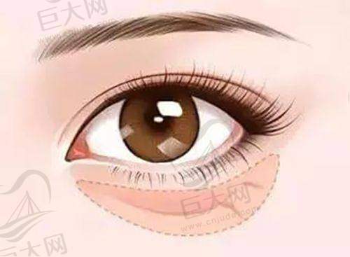 医美直播优惠套餐