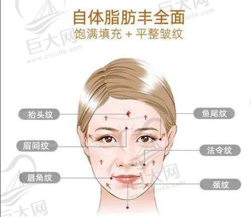 食道异物取出收费