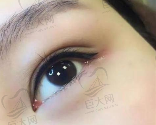 手术类整形项目专精